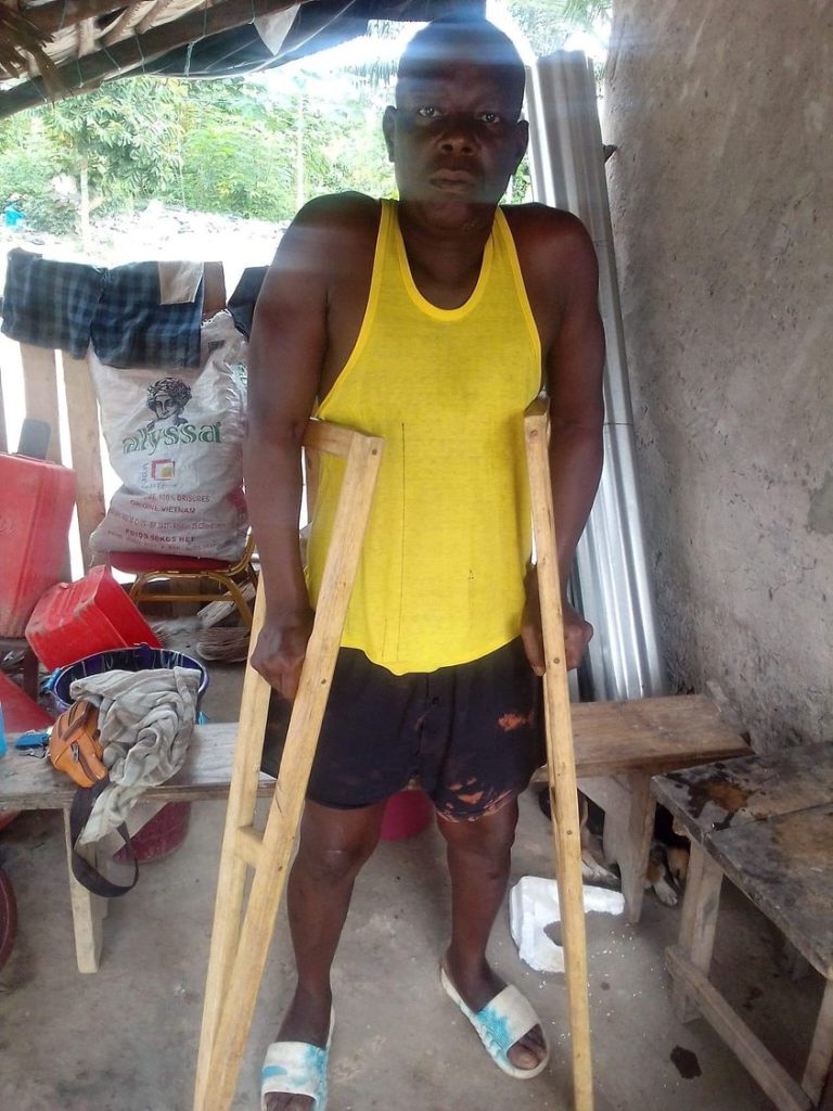 Appel à la Solidarité : Yapi Boua Roger, Résident d'Erymacouguie1, Agboville, Lance un SOS pour une Opération Chirurgicale Urgente